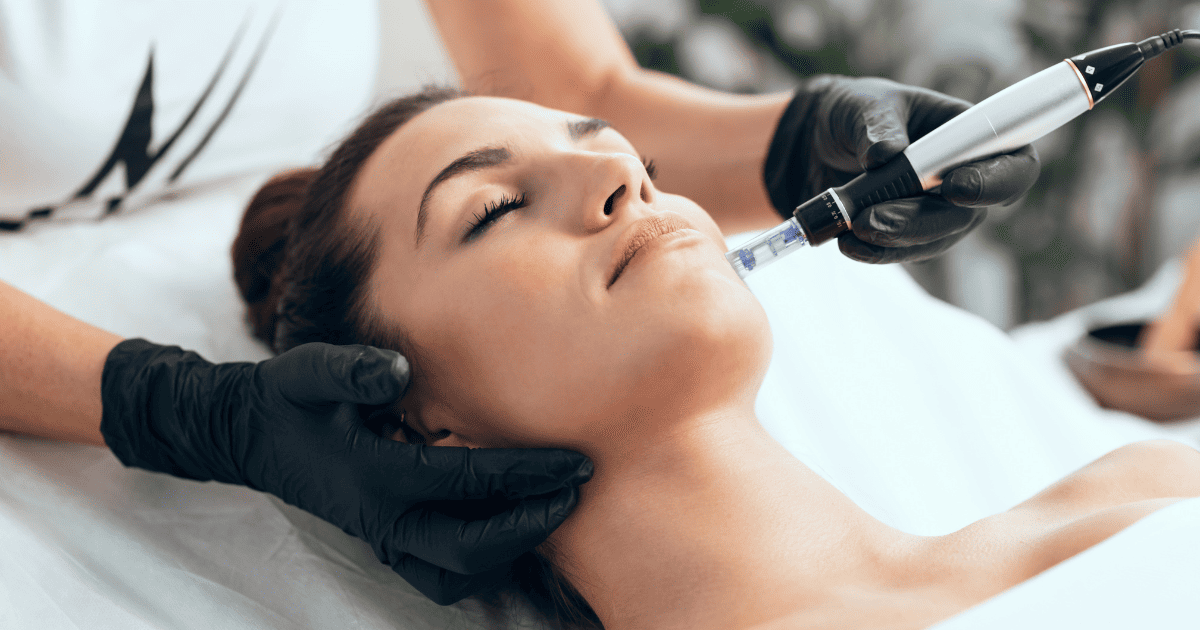 A woman getting microneedling in a medspa.